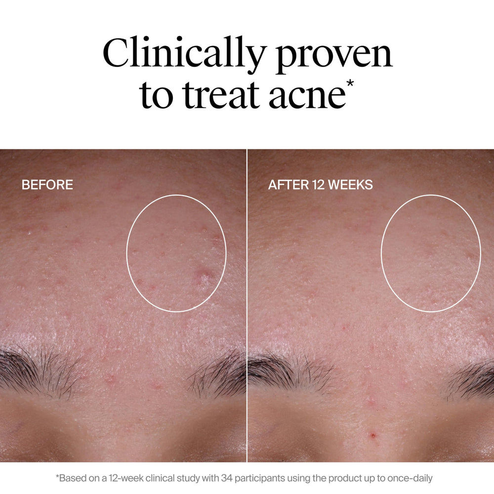 Neutrogena Evenly Clear Exfoliante, rápida absorción sin grasa.