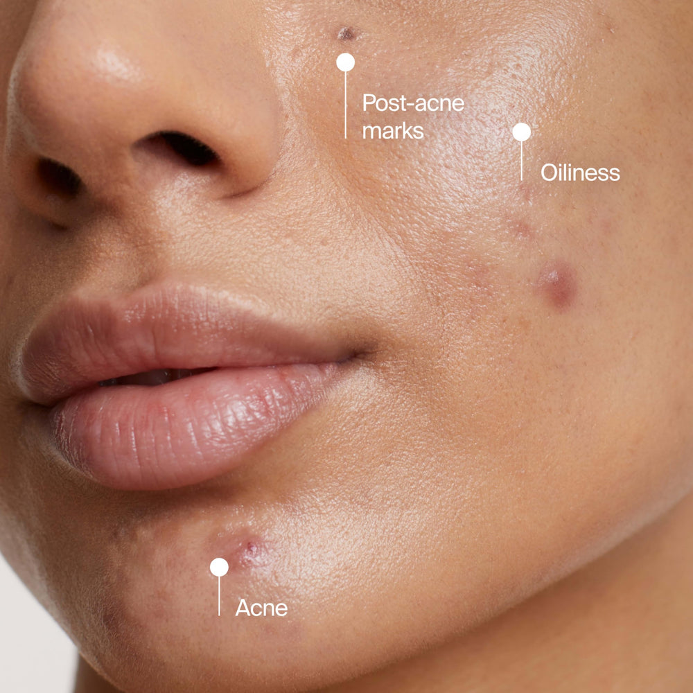 Neutrogena Evenly Clear: fórmula libre de fragancias para piel sensible.