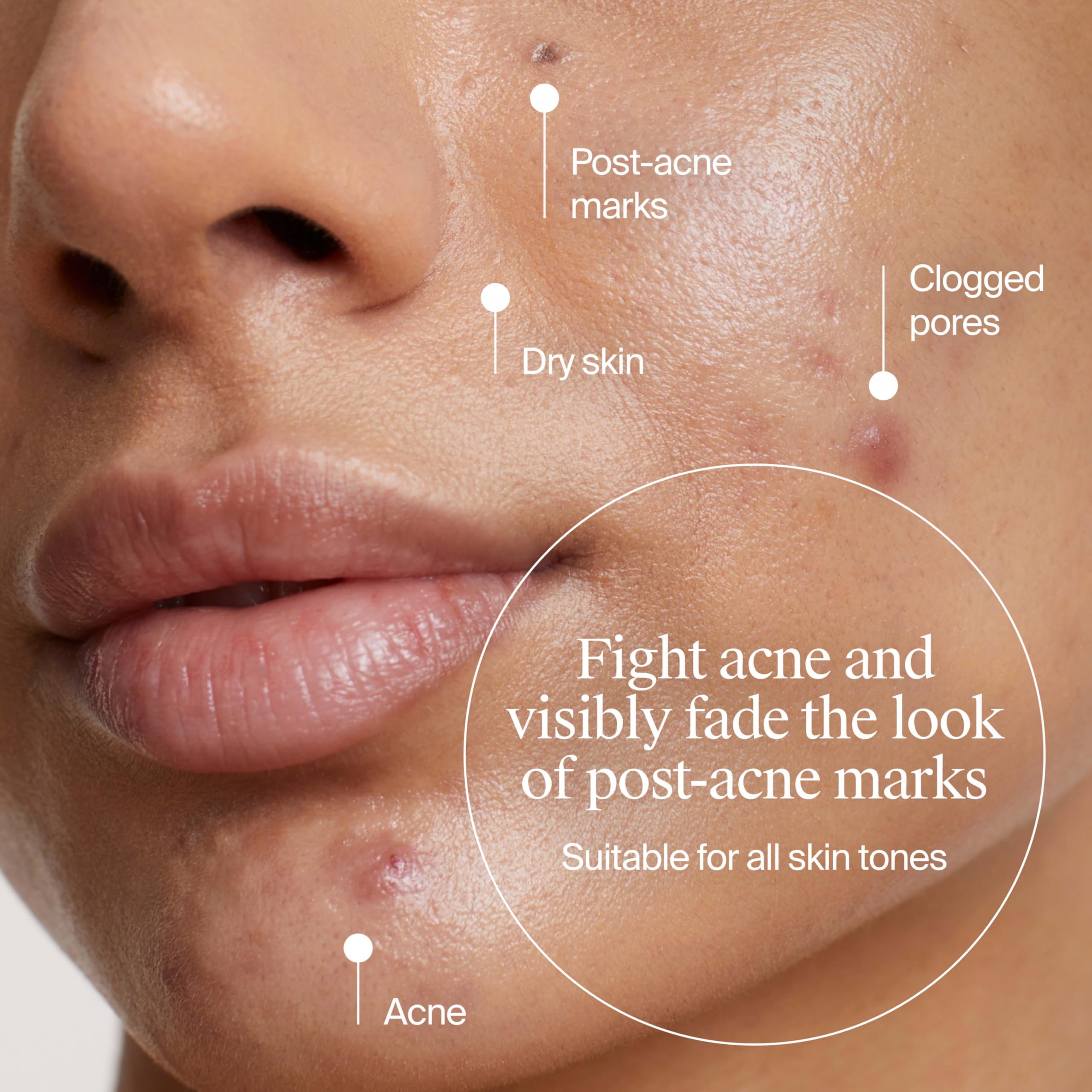 Neutrogena Evenly Clear hidratante ligero para claridad de la piel.