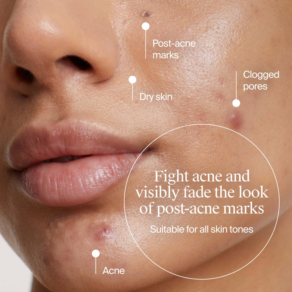 Neutrogena Evenly Clear hidratante ligero para claridad de la piel.