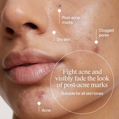 Neutrogena Evenly Clear hidratante ligero para claridad de la piel.