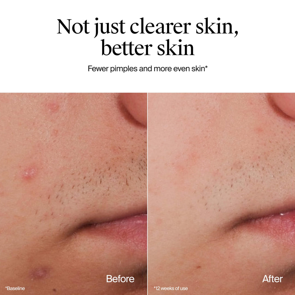 Neutrogena Fragancia cero, uso diario para piel sensible.