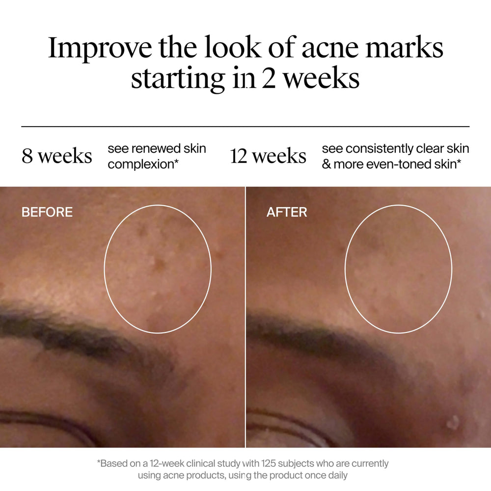 Neutrogena gel aplicacion diaria una capa para toda la cara