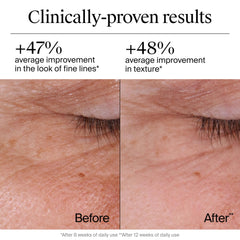Neutrogena hyaluronic acid moisturizer shown on hydrated, smooth-looking skin.
