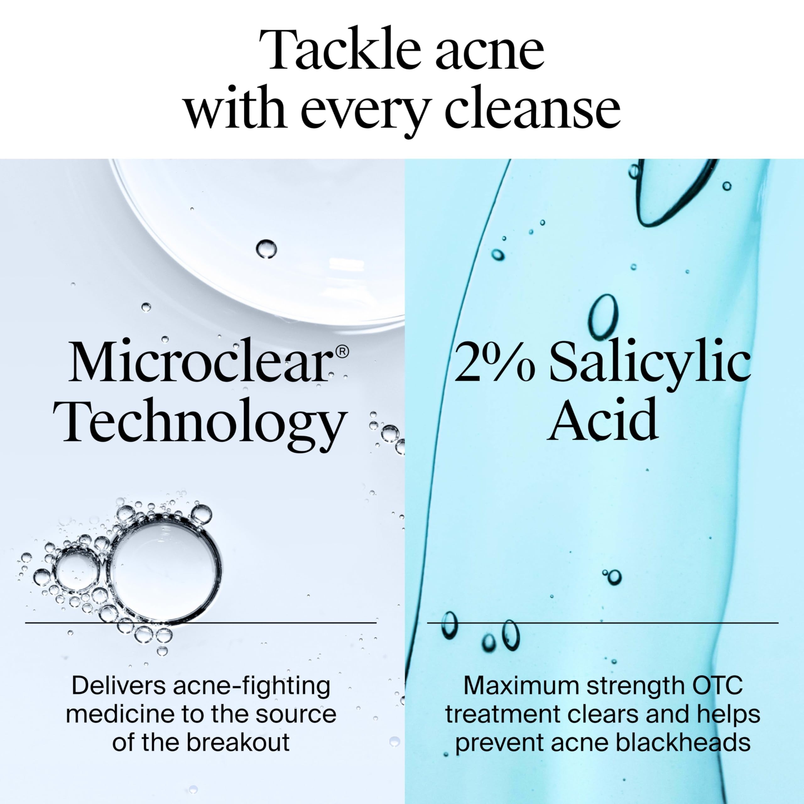 Neutrogena Acne Wash foam application photo showing lather.