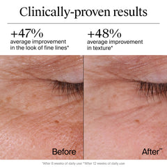 Neutrogena Rapid Wrinkle Repair applied to cheek smooths fine lines.