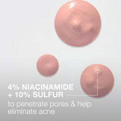 Neutrogena Stubborn Acne Spot Drying Lotion – foco en zona afectada para tratamiento localizado