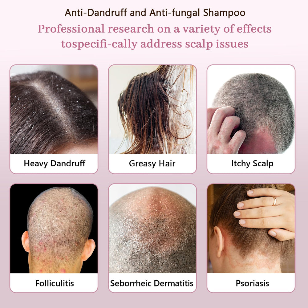 NEWREY anti-fungal shampoo after-use image suggesting calm, balanced scalp.