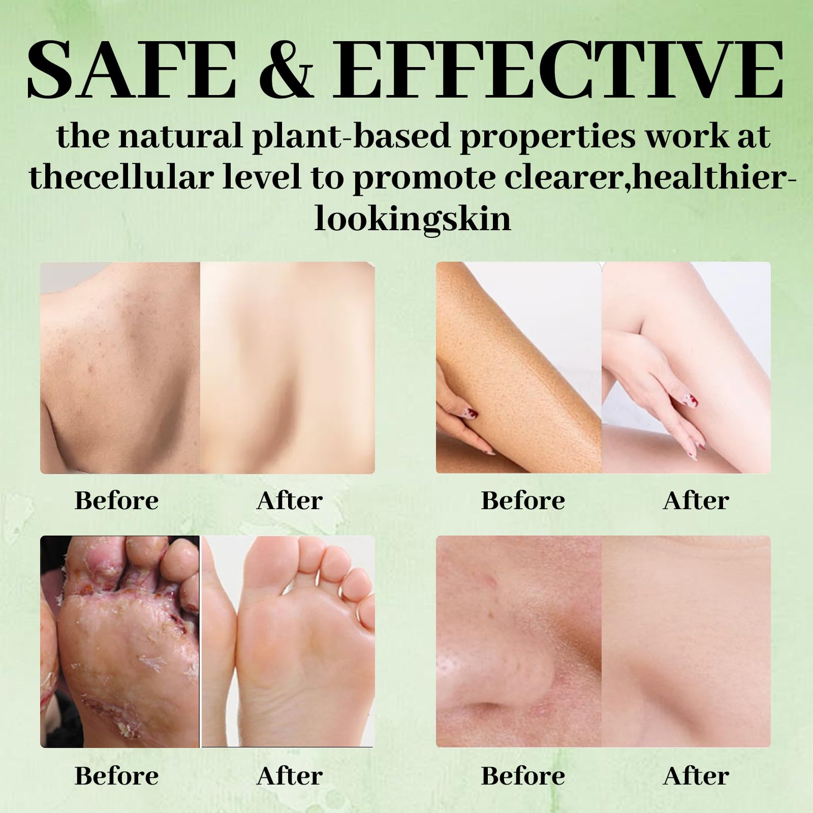 Rich lather from Nichalous Tea Tree Soap bar for gentle cleansing.