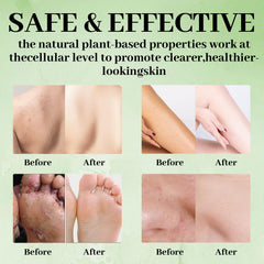 Rich lather from Nichalous Tea Tree Soap bar for gentle cleansing.