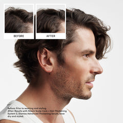 Nioxin Scalp closeup showing a clean, refreshed scalp for progressed thinning looks.