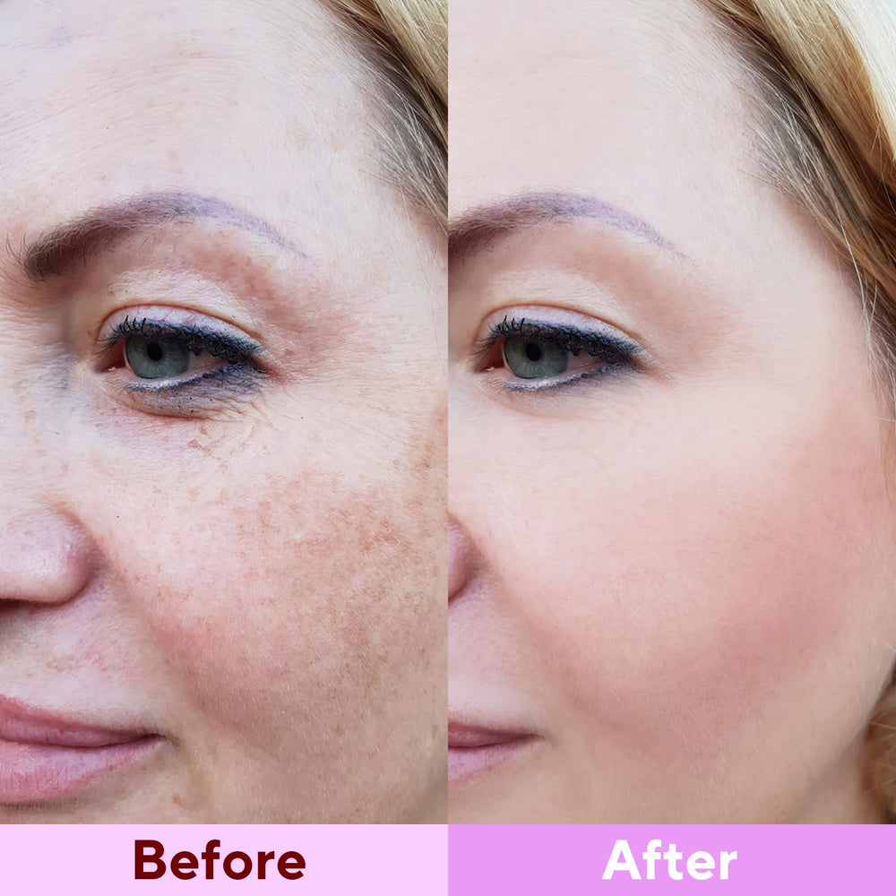 Nityrliv Bio-Colágeno Real Mascarilla ajuste perfecto al contorno facial