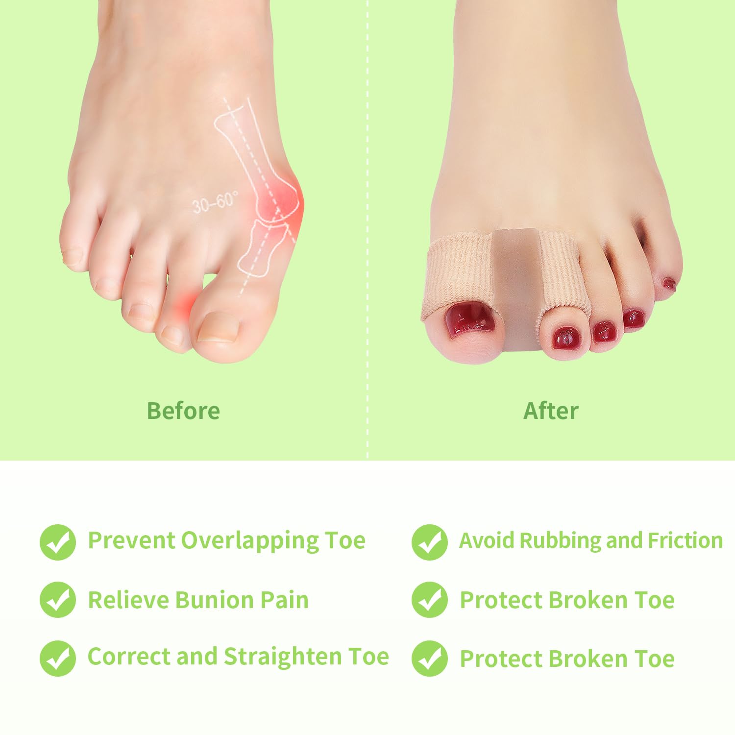 Niupiour bunion corrector protector provides built-in cushioning for bunion areas.