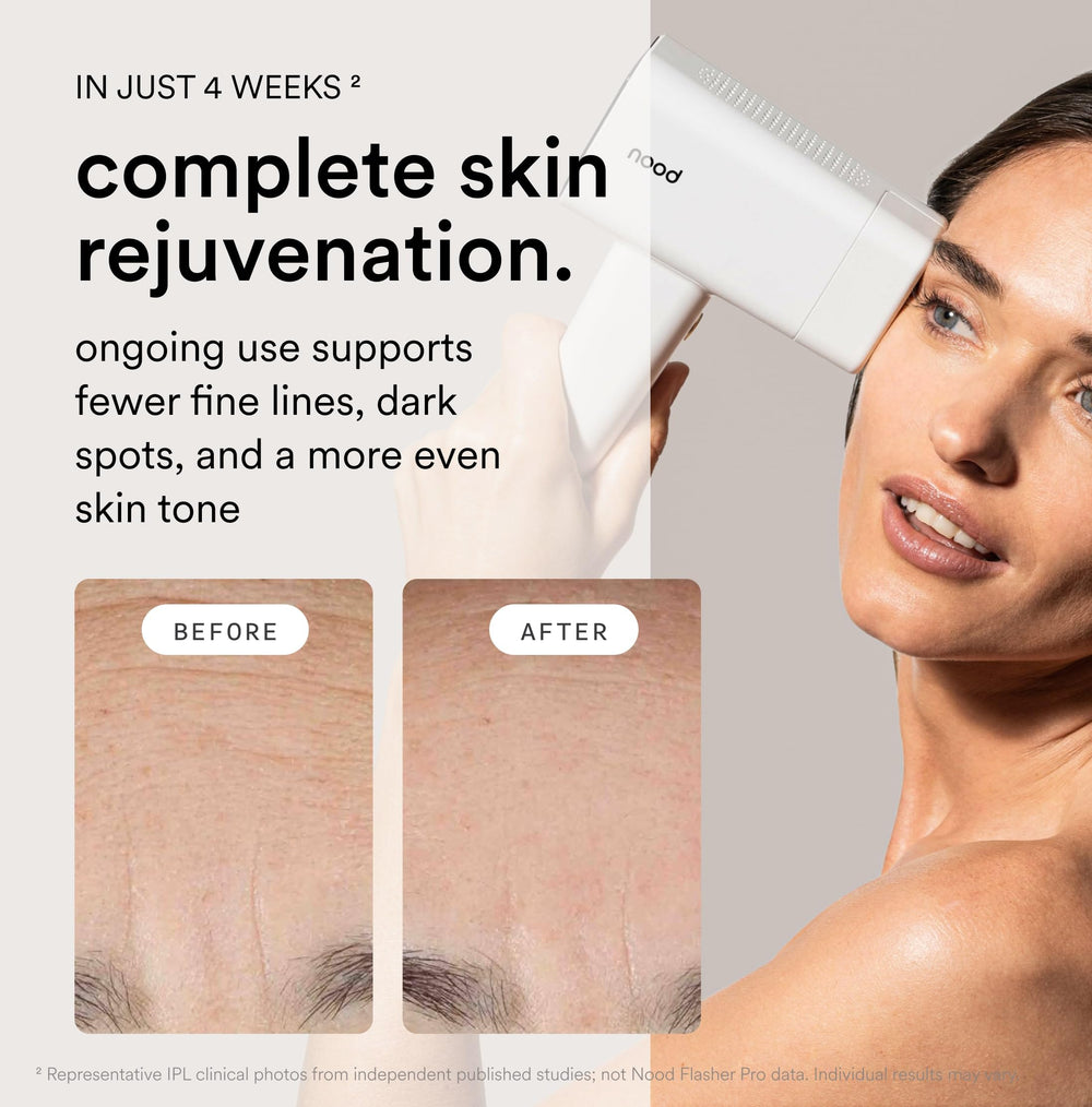 Nood Flasher Pro anti-aging lens for smoother-looking skin.