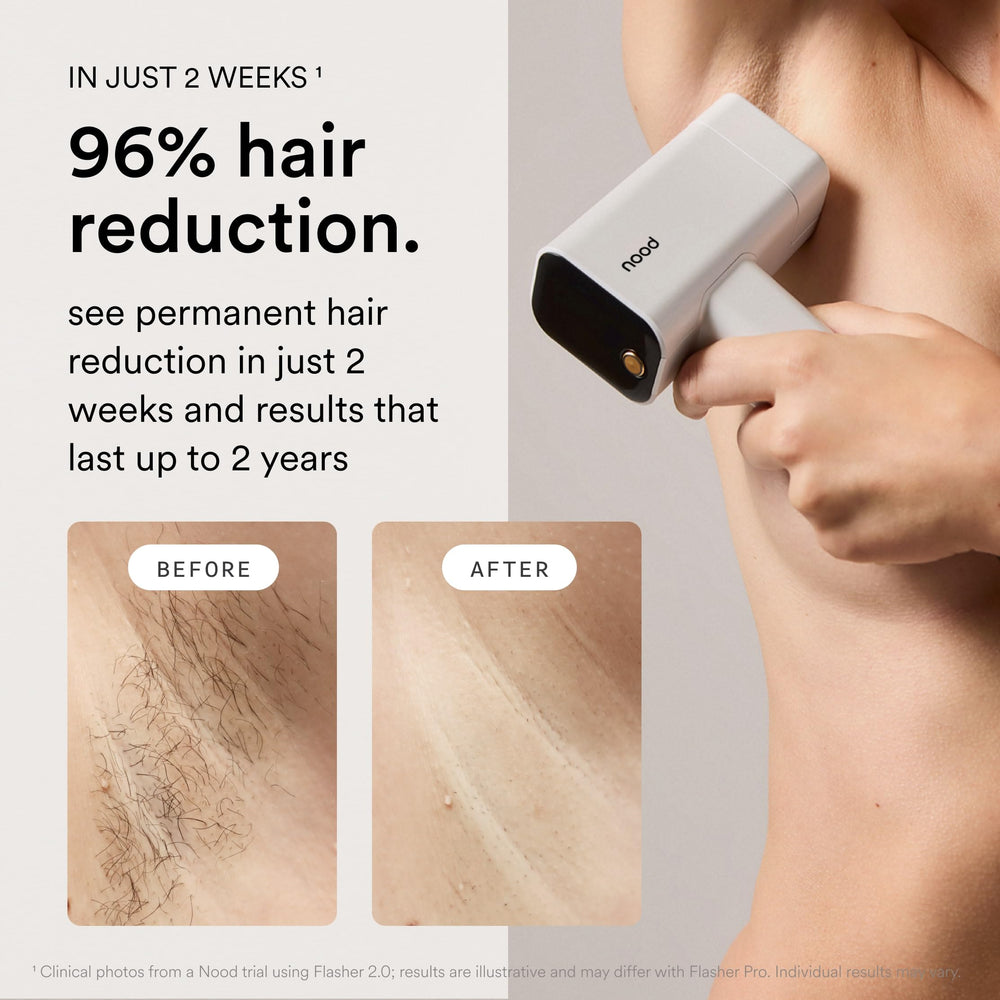 Nood Flasher Pro Ageless Lens swap for anti-aging treatment