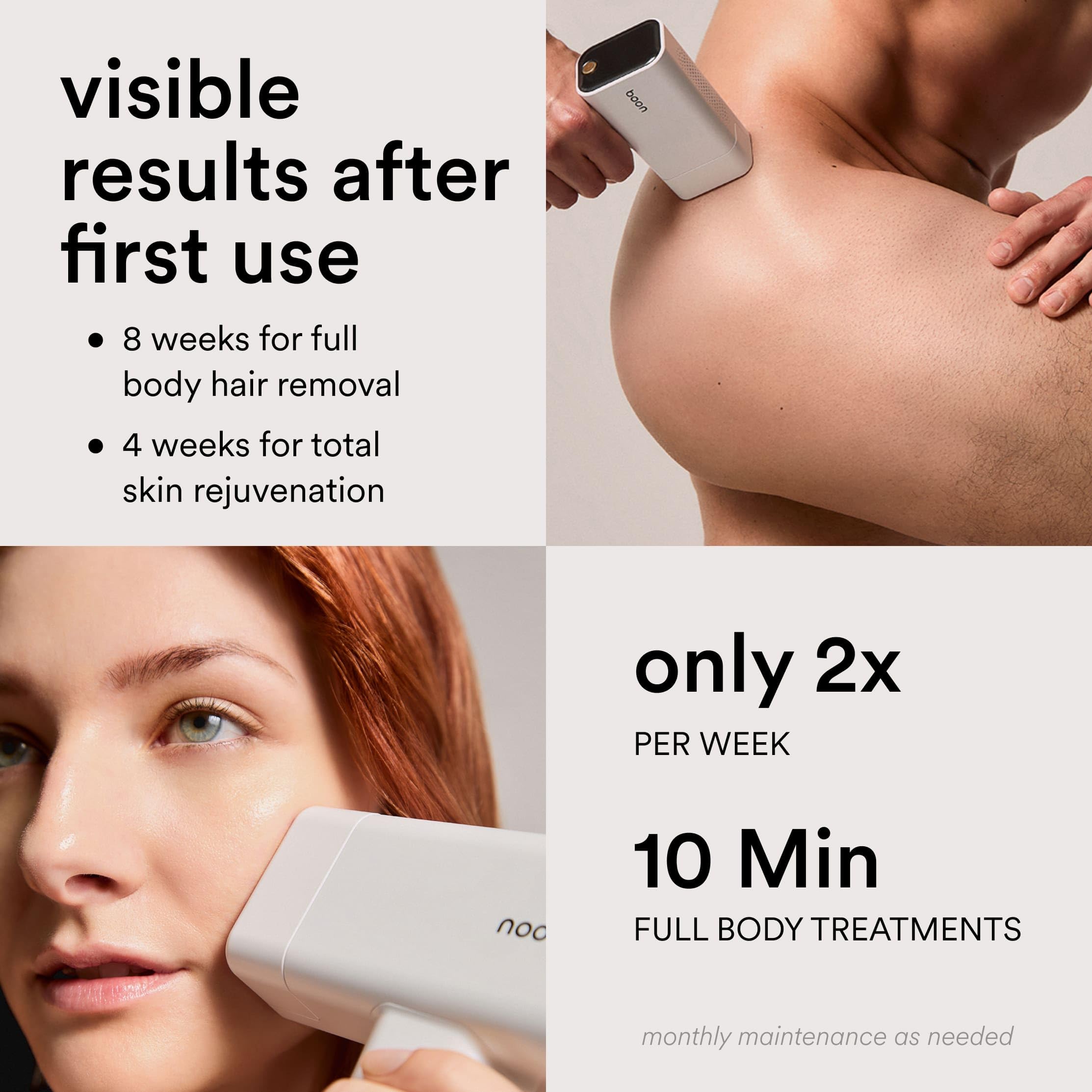 Nood Flasher Pro compact gloss-white design for home use.