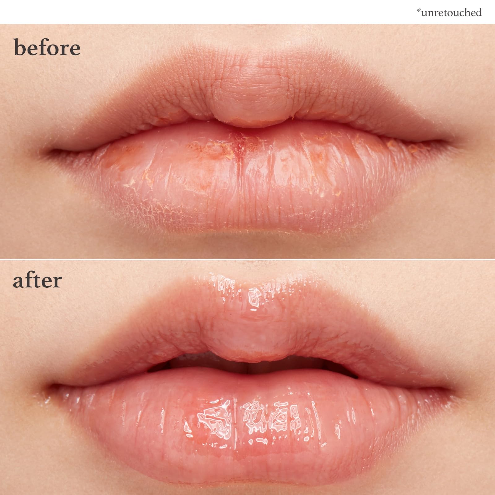 Labios lucen suave tras aplicar Nooni Applebutter Lip Mask.