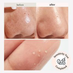 NOONI Snow Aqua 0 Ginseng: piel revitalizada tras la limpieza.