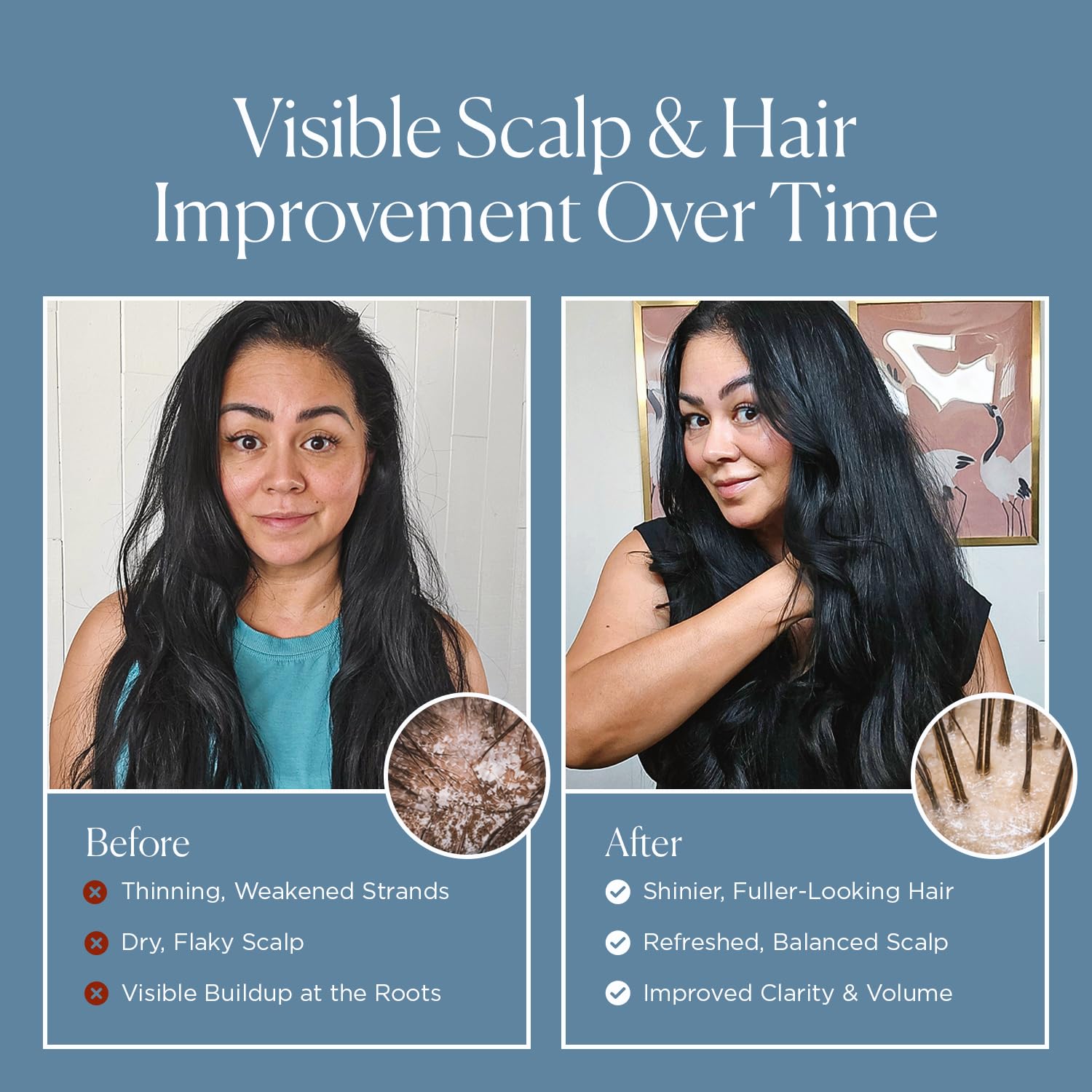Nora Ross soft hair strands imply smoother, more manageable texture.