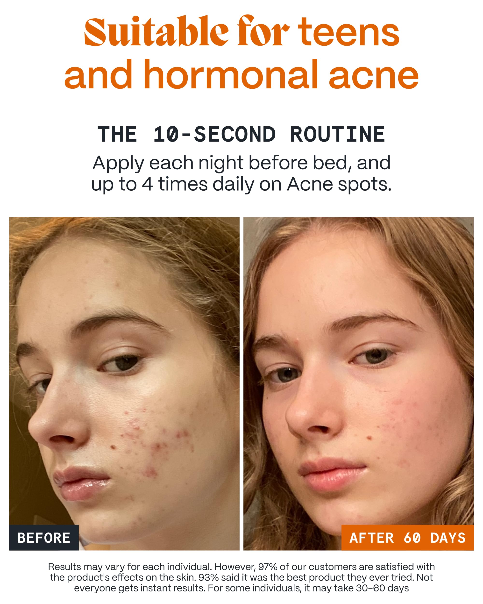 Norse Organics Mountain Marigold – potent botanical aiding redness reduction.