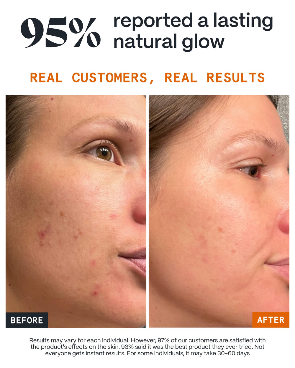 Norse Organics Pimple Stopper on face application shows fast absorbing daytime use