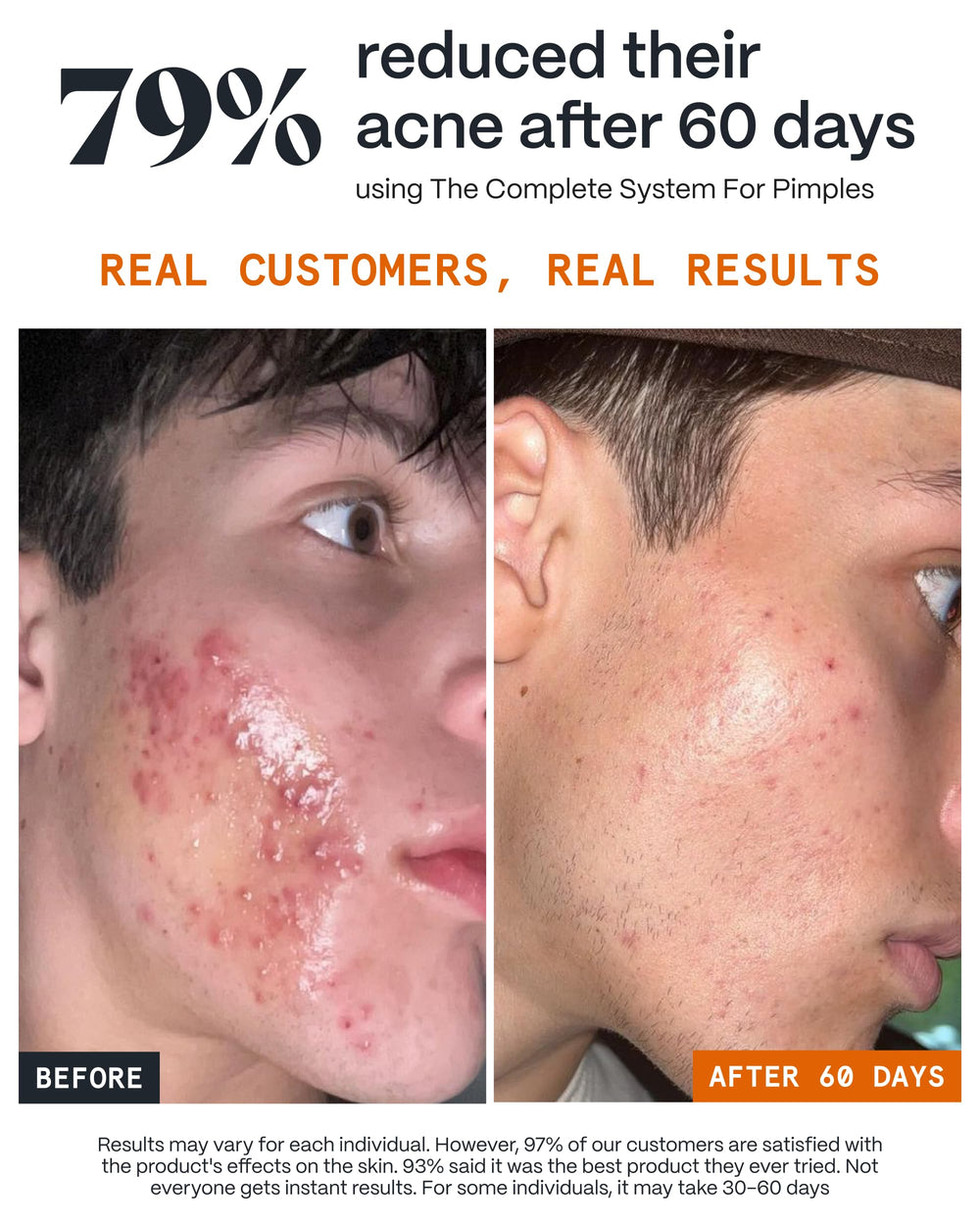 Norse Organics Night Balm applied to the cheek to calm redness
