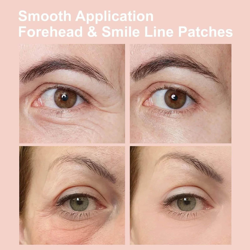NOVALIFT Kunnozz patches on skin providing hydration for fine lines around eyes.