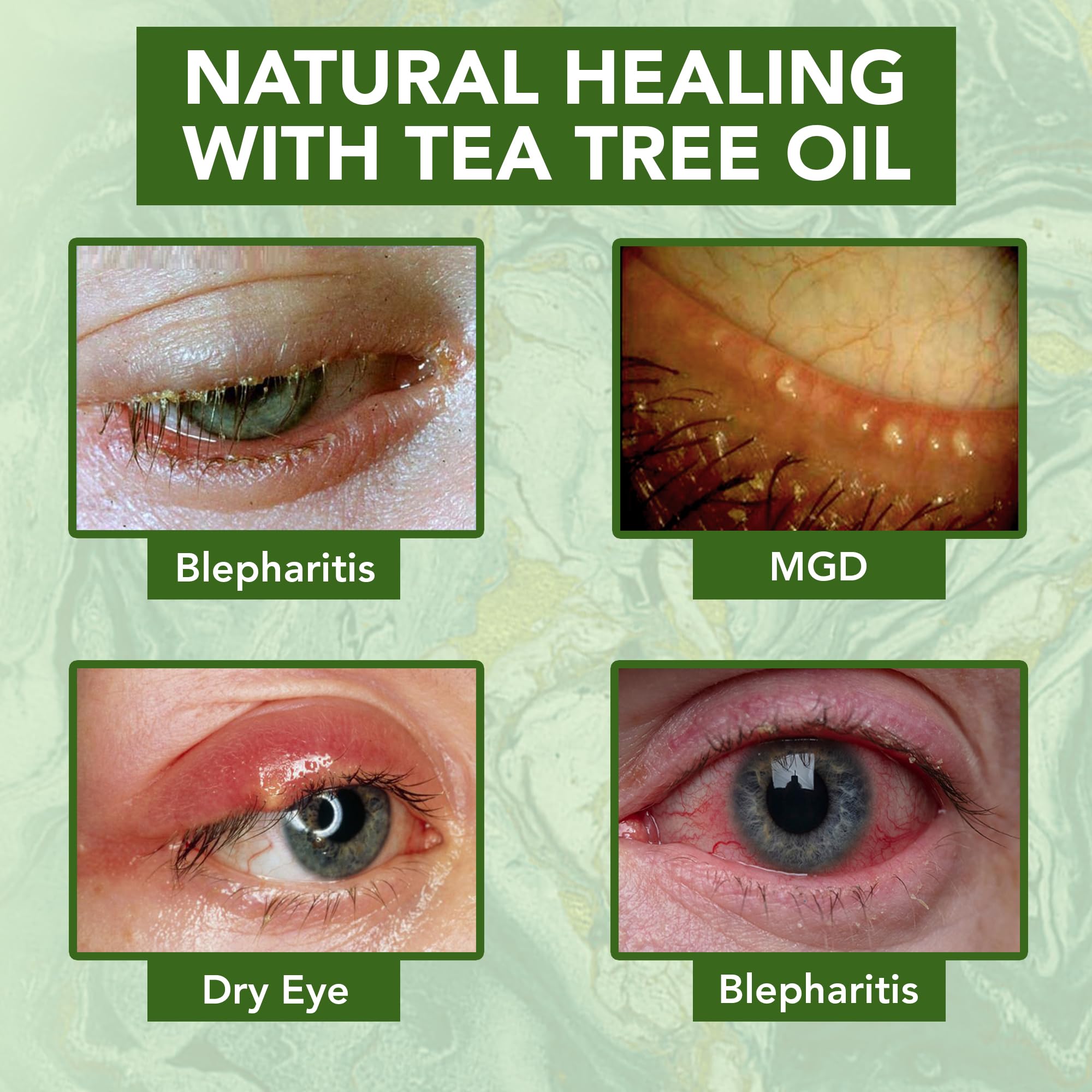 NOVEHA crema ojos antiarrugas mejora elasticidad y suaviza lineas finas.