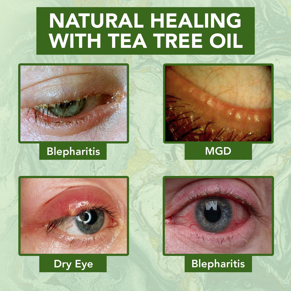 NOVEHA crema ojos antiarrugas mejora elasticidad y suaviza lineas finas.