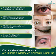 NOVEHA Demodex Eyelid Cleanser Foam close-up shows rich lather for eyelid hygiene.