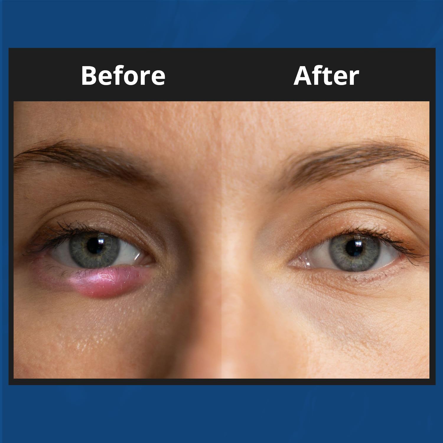 NOVEHA XStye: extracto de pepino para calmar la piel sensible alrededor de los ojos.