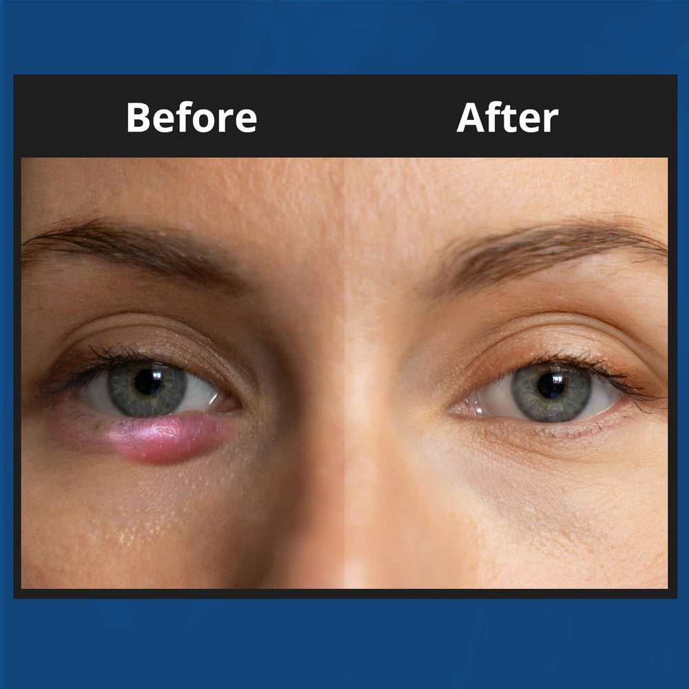 NOVEHA XStye: extracto de pepino para calmar la piel sensible alrededor de los ojos.