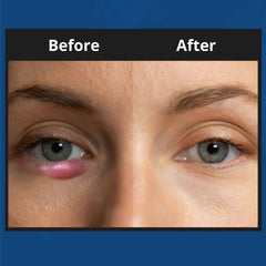 NOVEHA XStye: extracto de pepino para calmar la piel sensible alrededor de los ojos.