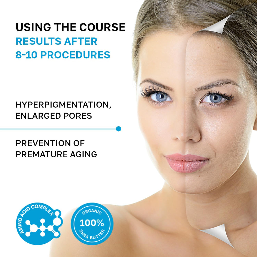 NSC Name Skin Care CO2 mask application with cooling gel experience