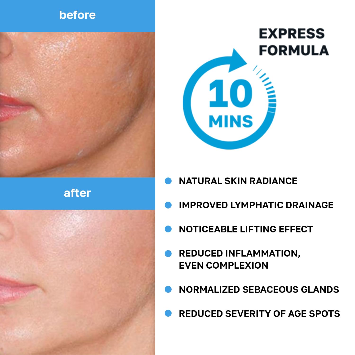 NSC Name Skin Care CO2 neck sheet focusing on firmer neck appearance