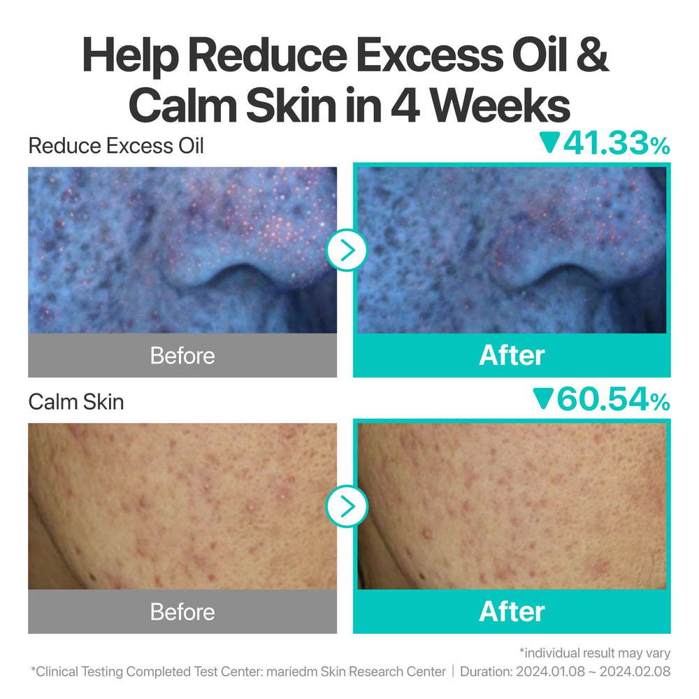 aplicación nocturna de numbuzin No.1 como mascarilla de noche