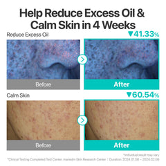aplicación nocturna de numbuzin No.1 como mascarilla de noche