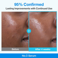 Blue Bio-Retinol y Niacinamida en numbuzin No.3 Serum