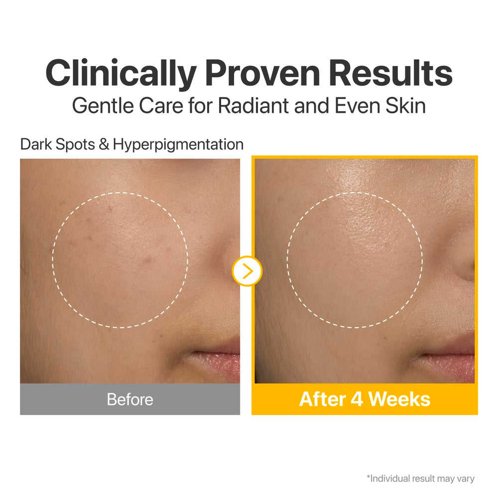 Numbuzin No.5 serum ingredients-pack spotlights Tranexamic Acid and Niacinamide benefits