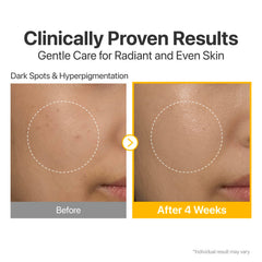 Numbuzin No.5 serum ingredients-pack spotlights Tranexamic Acid and Niacinamide benefits
