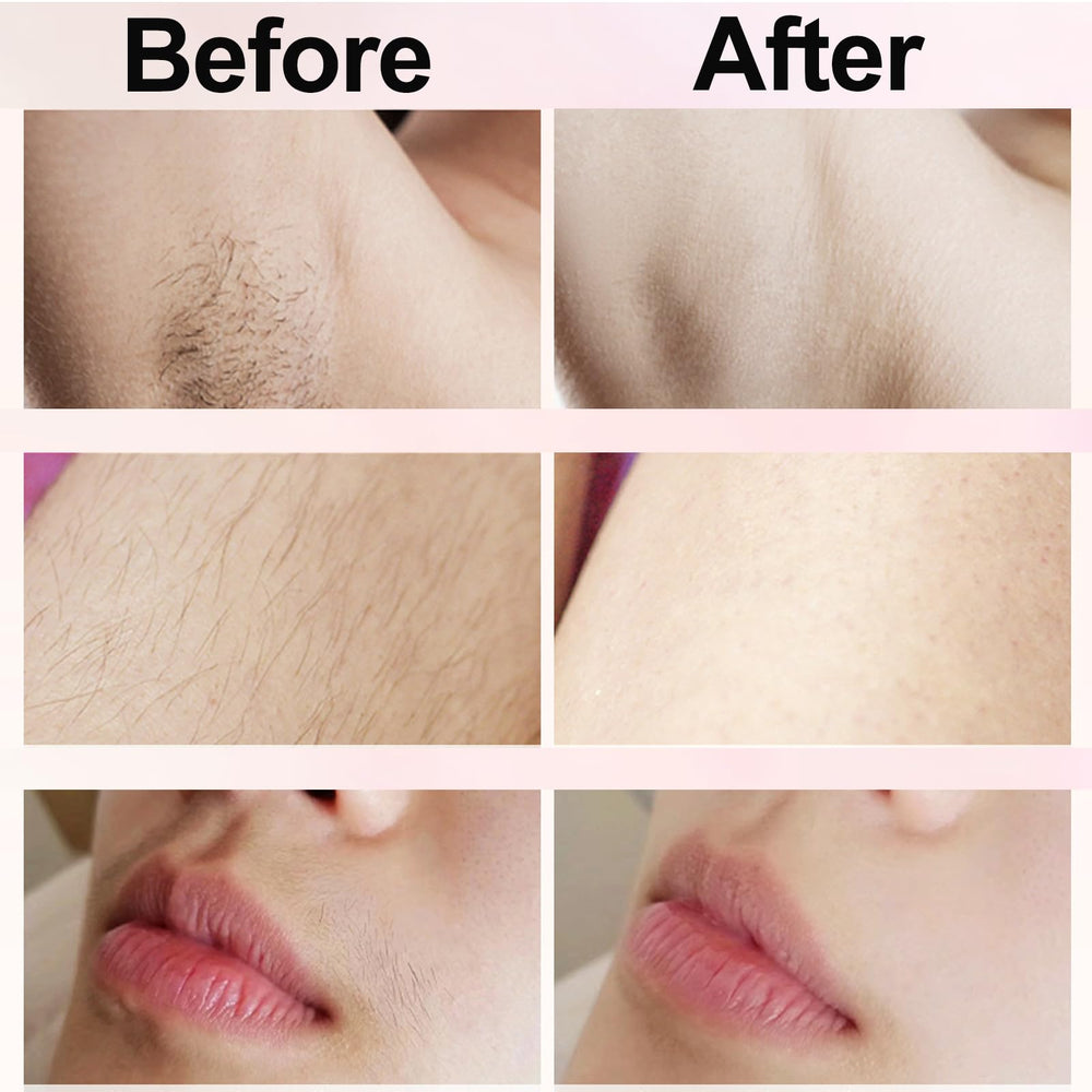 Nursetek hypoallergenic blades reduce irritation on sensitive skin.