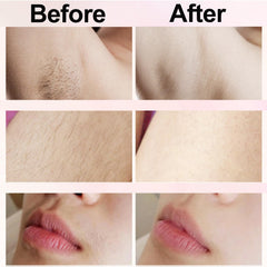 Nursetek hypoallergenic blades reduce irritation on sensitive skin.