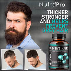 Close-up of NutraPro hair growth pills ready for daily dosage and thicker hair potential.