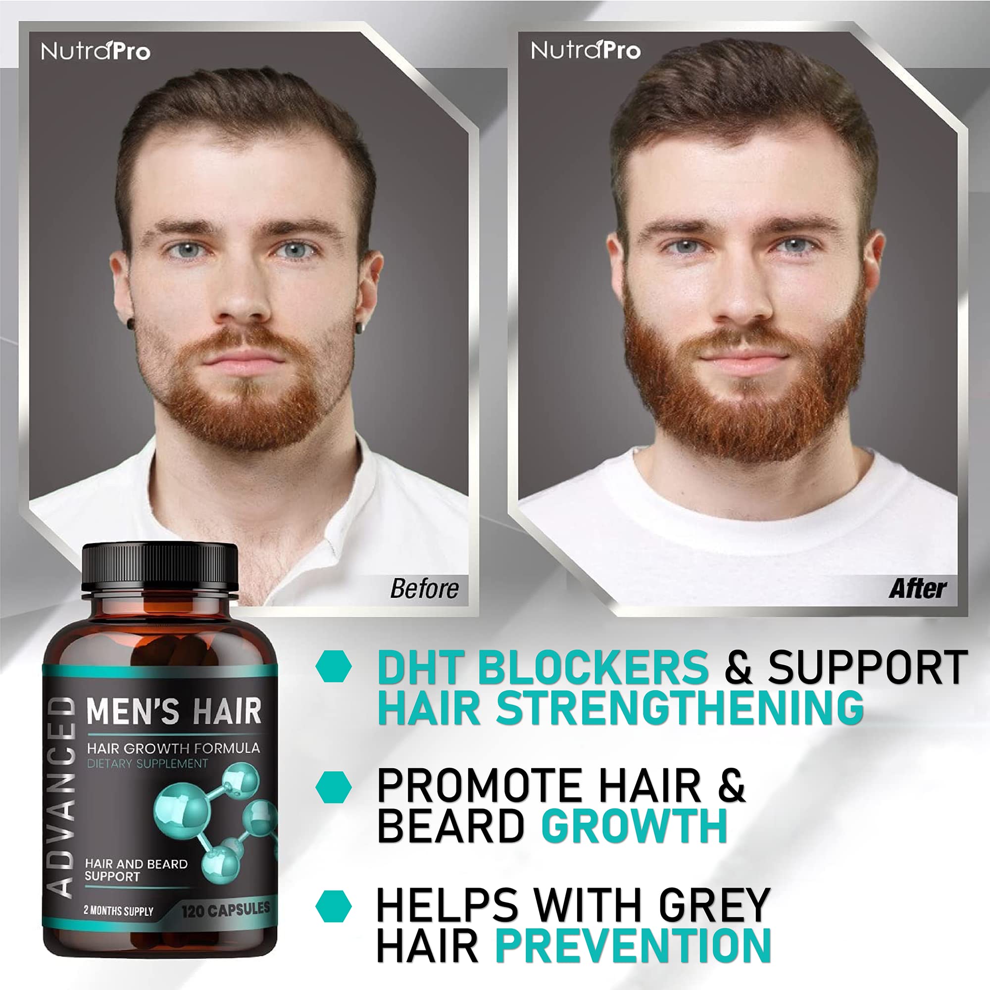 NutraPro image focusing on hairline and crown support for targeted male hair health.