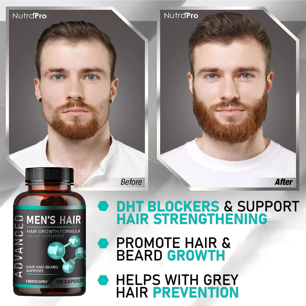 NutraPro image focusing on hairline and crown support for targeted male hair health.