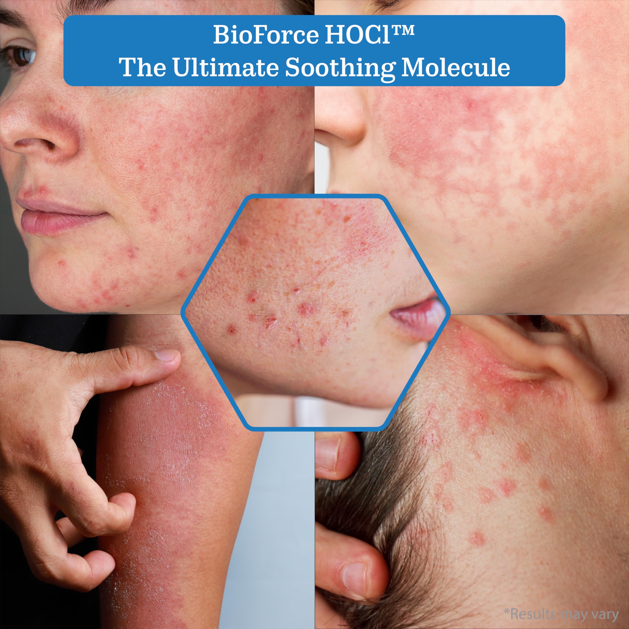 NueVue BioForce HOCl refill for piercing aftercare in clinical setting.