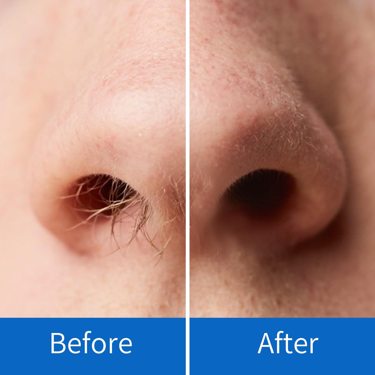 After use, OAKEER may support more confident breath for beach days.