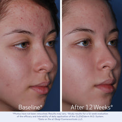 Obagi CLENZIderm M.D. Pore Therapy label highlights 2% salicylic acid.