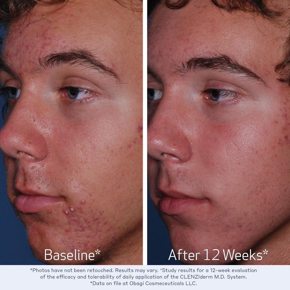 Close-up of Obagi CLENZIderm M.D. Pore Therapy texture for exfoliation.