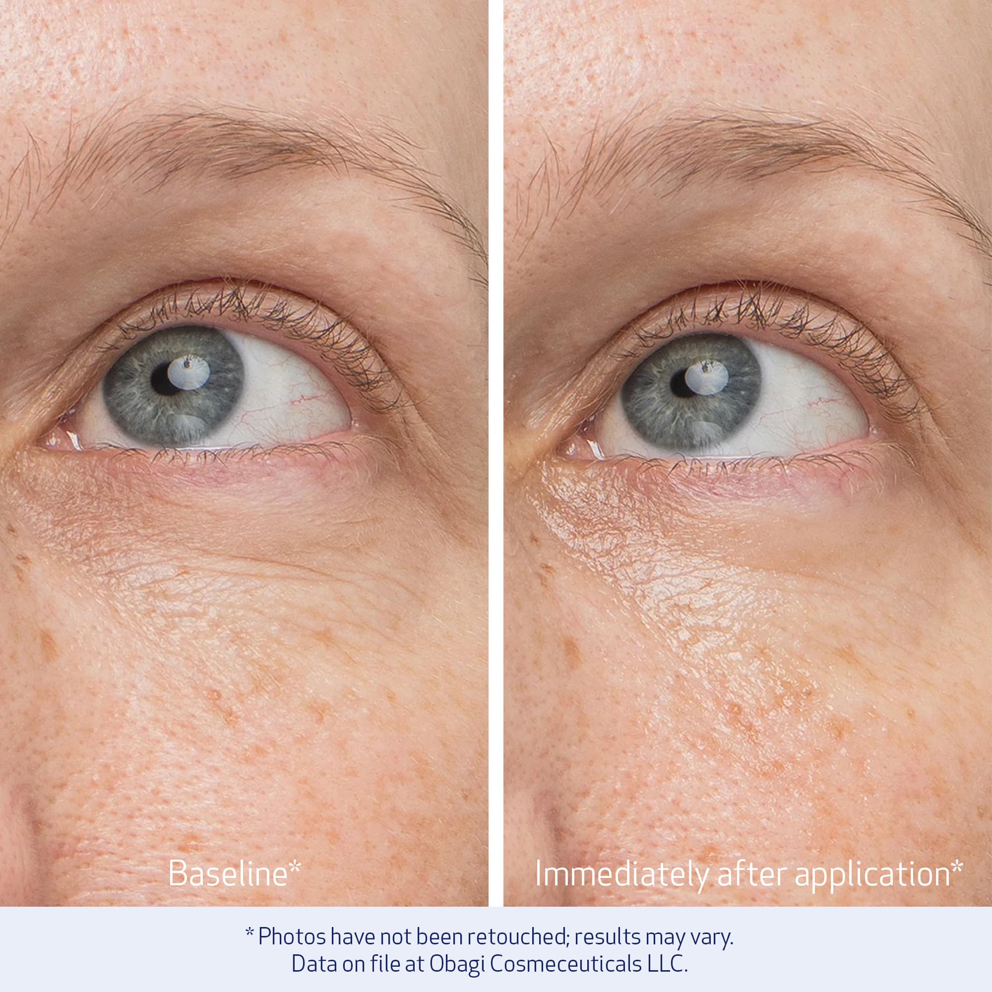 Applying Obagi Daily Hydro-Drops Eye Gel around the under-eye area for refreshed skin.